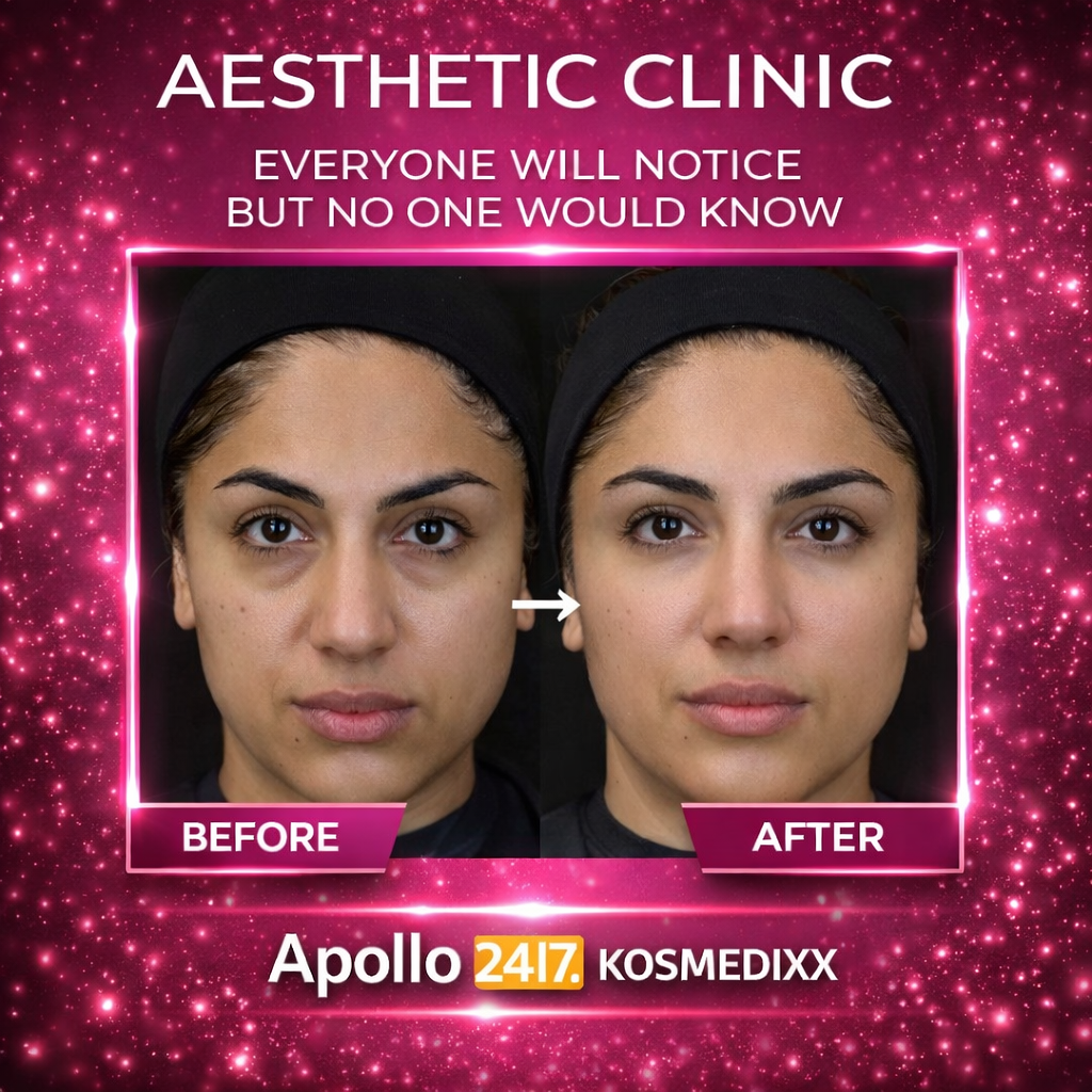 Liquid Face Lift