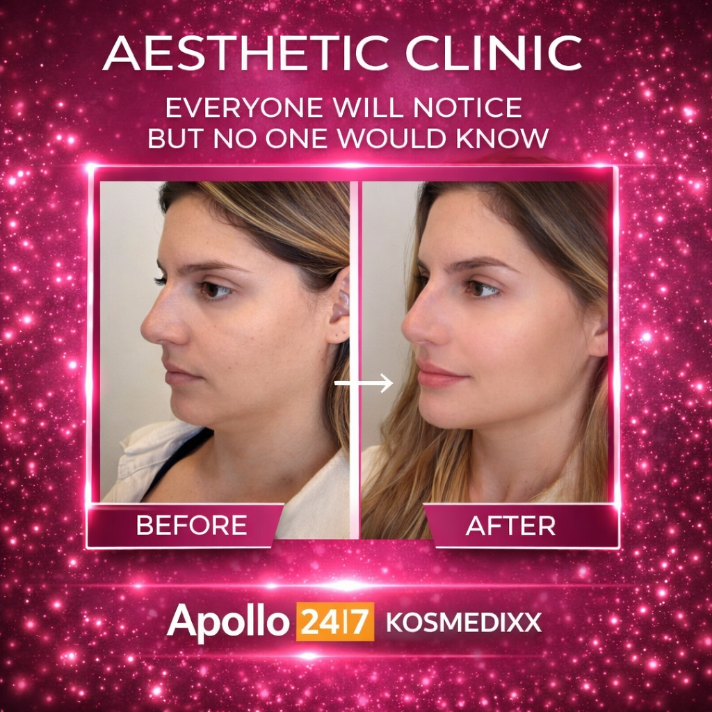 Liquid Face Lift